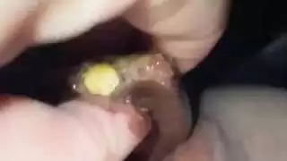 المرة الأولى لفتاة عربية عذراء: بي بي سي قاسي في الولايات المتحدة